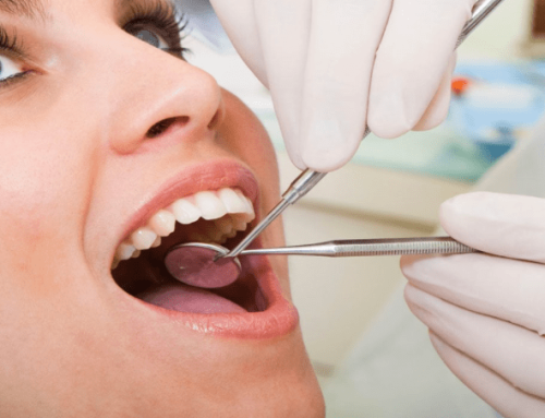 Why Dental Implants May Be Right for You